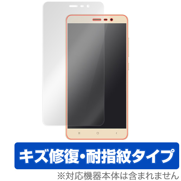 OverLay Magic for Xiaomi Redmi Note 3