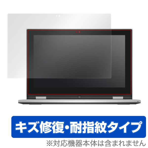 OverLay Magic for DELL Inspiron 11 3000シリーズ 2 in 1