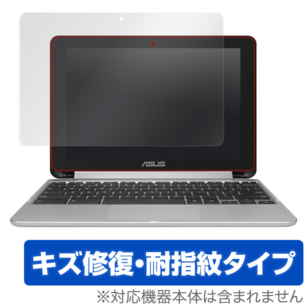 OverLay Magic for ASUS Chromebook Flip C101PA