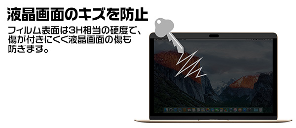 MacGuard ޥͥåȼץ饤Хե for MacBook Pro 15(Late 2016)