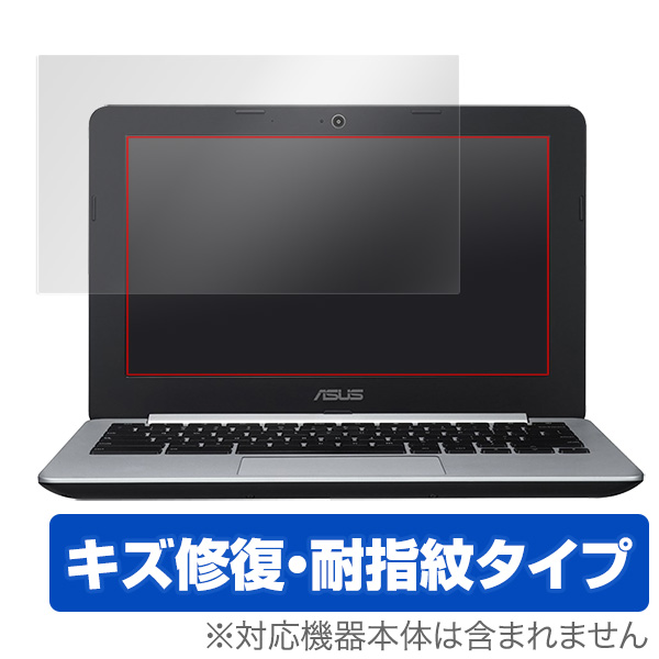 OverLay Magic for ASUS Chromebook C202SA / C200MA