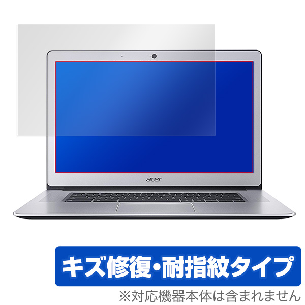 OverLay Magic for Acer Chromebook 15 CB515-1HT