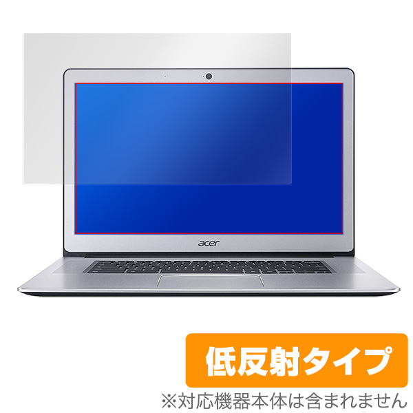 OverLay Plus for Acer Chromebook 15 CB515-1HT
