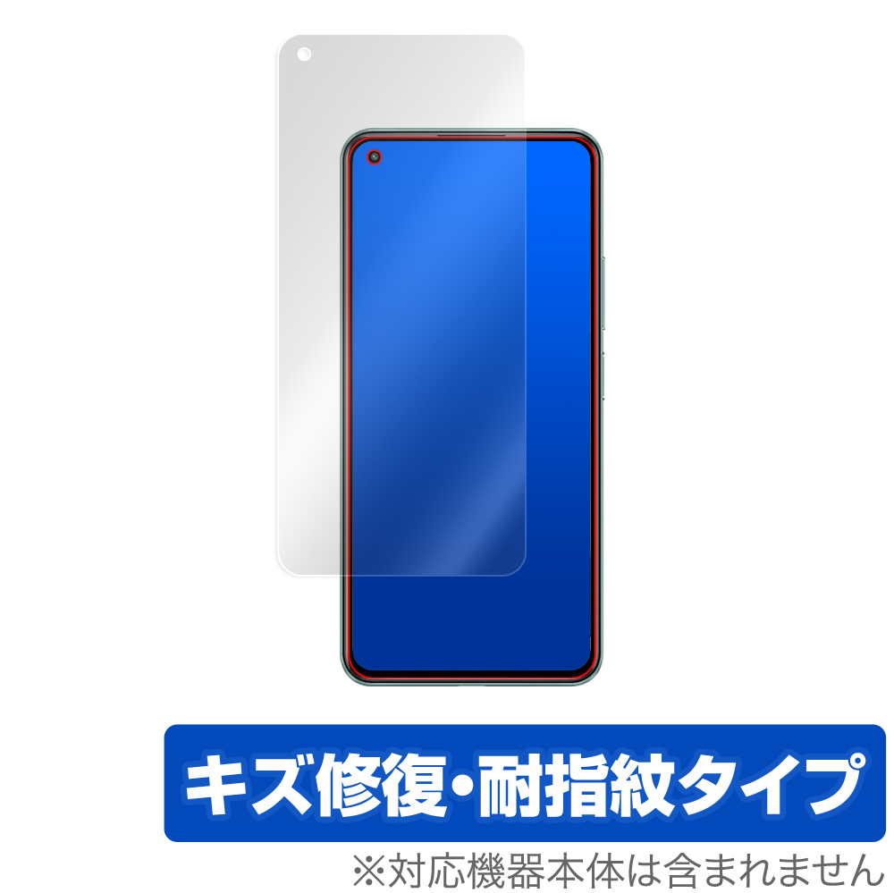 保護フィルム OverLay Magic for Xiaomi Mi 11 Lite 5G 表面用保護シート