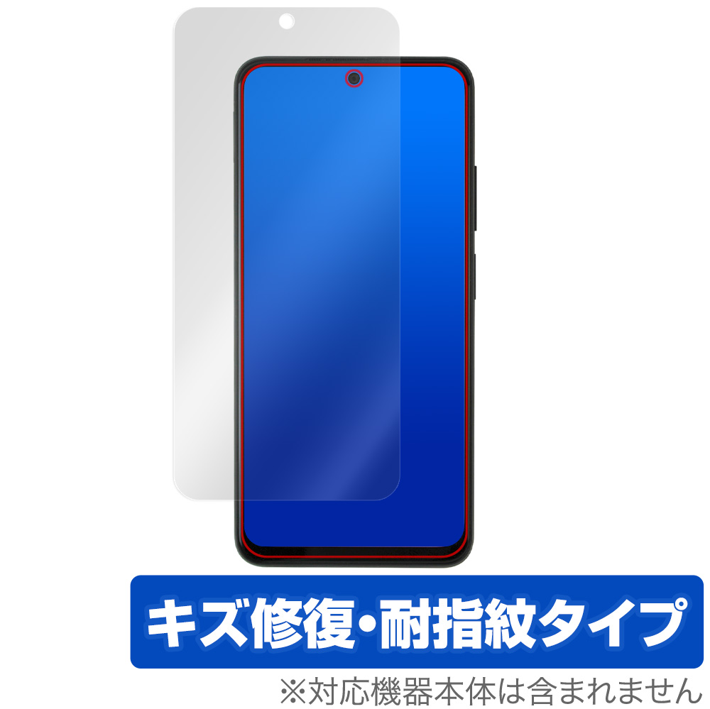 保護フィルム OverLay Magic for Xiaomi Redmi Note 11S / 11 表面用保護シート