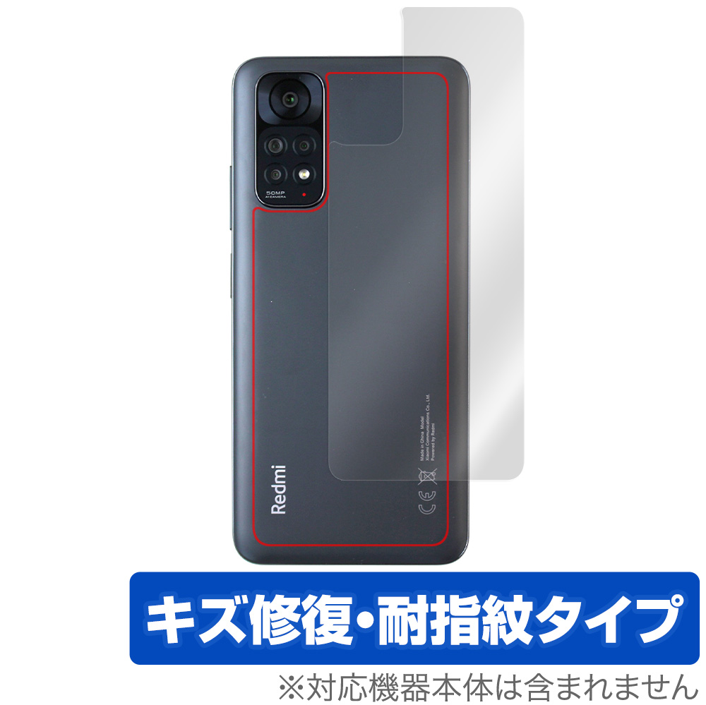 保護フィルム OverLay Magic for Xiaomi Redmi Note 11S / 11 背面用保護シート