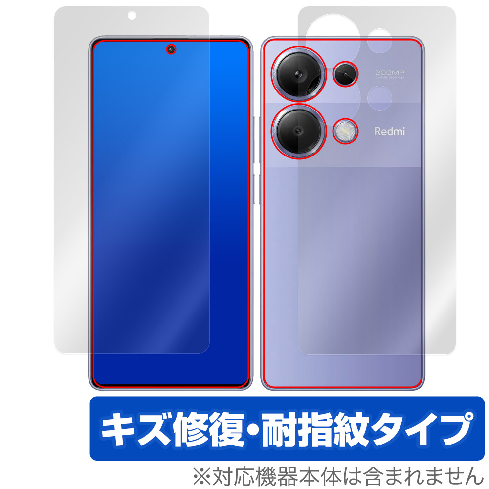 保護フィルム OverLay Magic for Xiaomi Redmi Note 13 Pro 4G 表面・背面セット