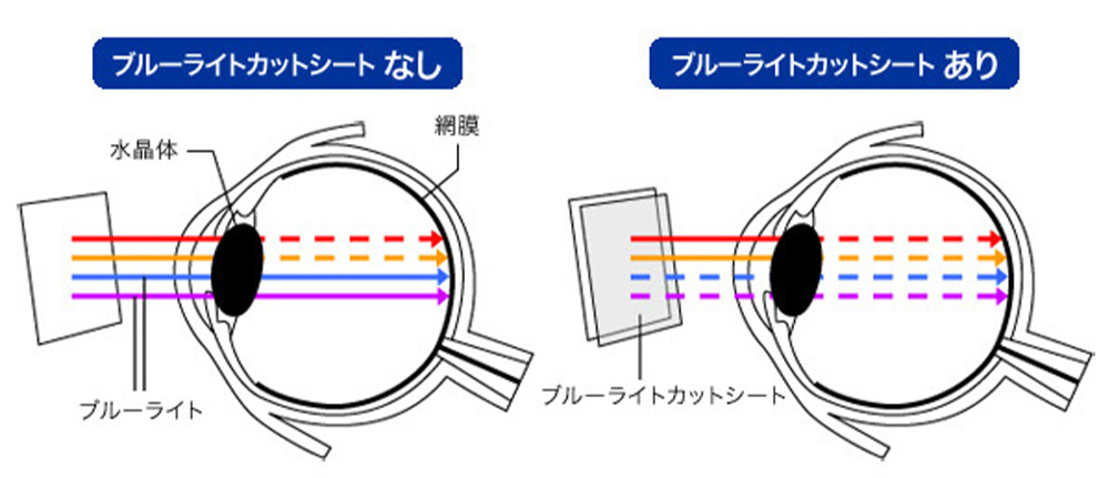 ブルーライトの眼球への影響を軽減 OverLay Absorber 衝撃吸収低反射 保護フィルム 低反射 説明画像